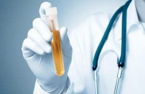 How to Pass Life Insurance Urine Test?